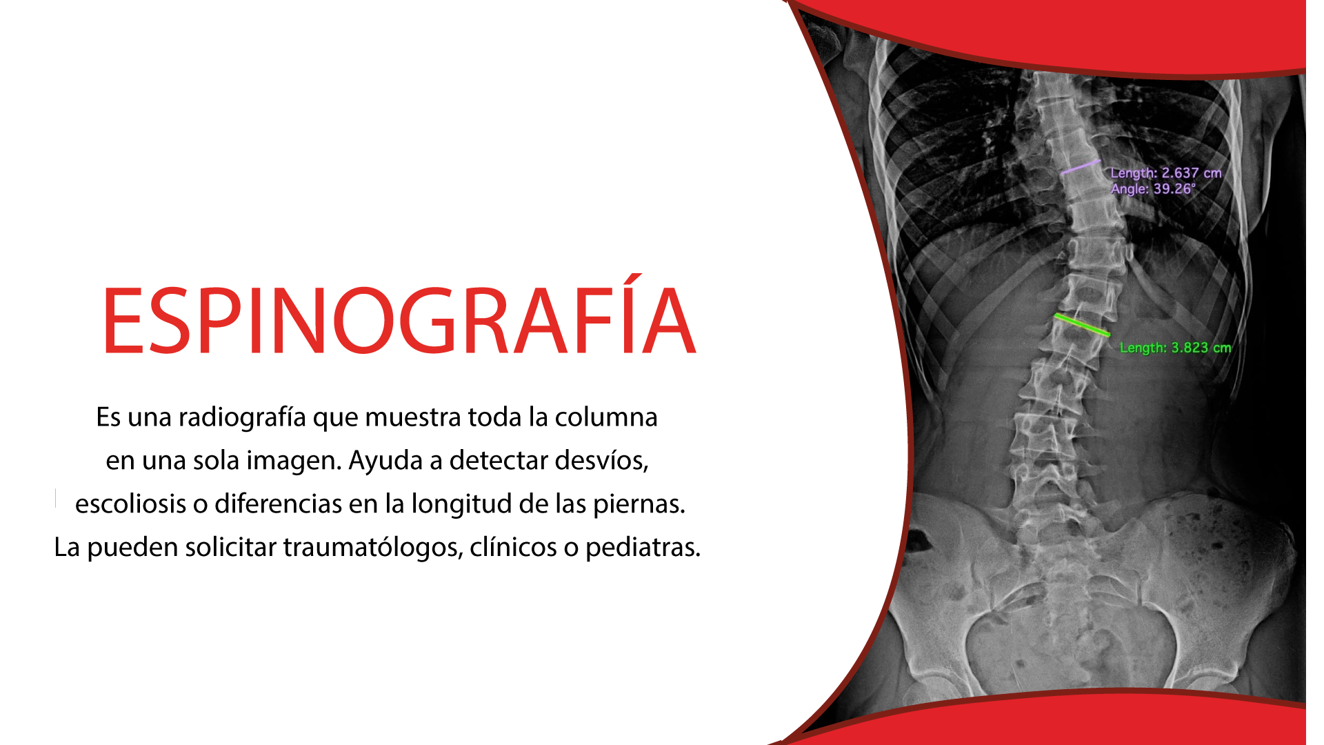 Nuevo estudio de Espinografía